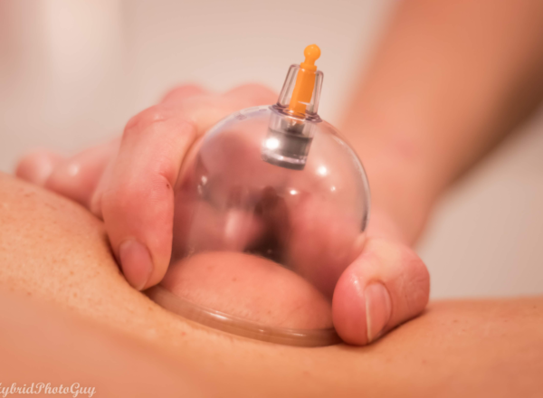 Cupping-prisside1920 Cupping-prisside1920